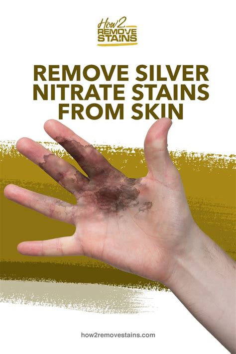 Reveal Your Flawless Skin: Bid Goodbye to Stubborn Stains with These Quick and Easy Methods!