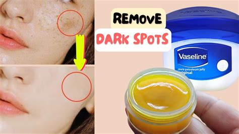Say Goodbye to Sticky Situations: Effortlessly remove Vaseline from your skin with these expert tips.