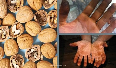 Crack the Code: The Ultimate Guide to Painlessly Removing Walnut Skin