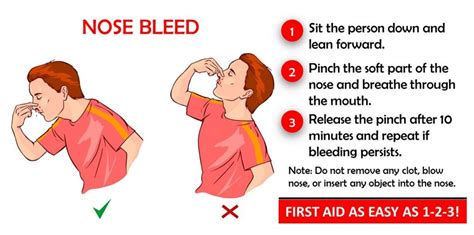 How To Stop A Nosebleed