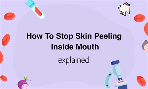 Say Goodbye to Painful Mouth Irritation: Discover Effective Ways to Stop Skin Peeling Inside Your Mouth