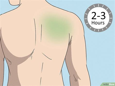 7 Easy Steps to Soothe Your Skin: How to Safely Remove Icy Hot from Your Body