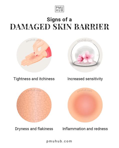 Unmasking the Hidden Signs of Skin Barrier Damage: Learn How to Identify and Treat it Like a Pro!