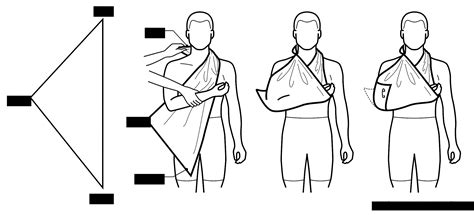 Master the Art of Sling Tying with Our Easy-to-Follow Guide