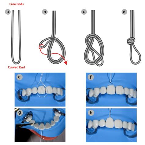 Mastering Oral Care: Step-by-Step Guide on How to Tie Floss Around a Tooth Like a Pro