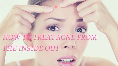 How To Treat Acne From The Inside Out
