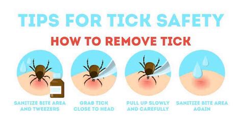 How to Check and Remove Ticks Safely