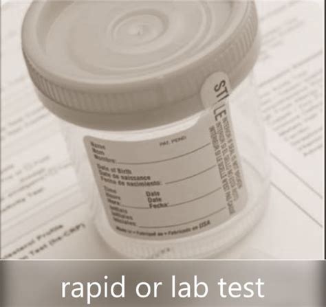 How to Choose a Lab Drug Test
