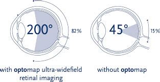 How to Integrate Dynamic Eye Care into Your Life