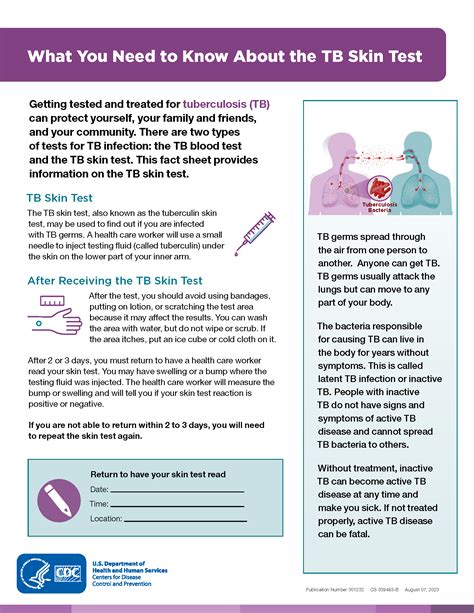 How to Prepare for a TB Test
