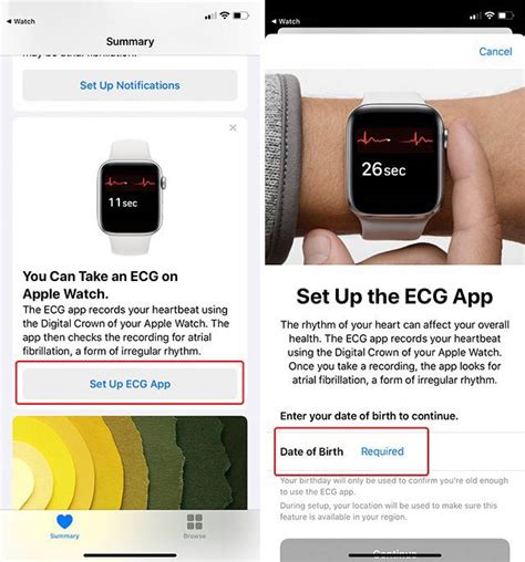 How to Set up ECG in Apple Watch