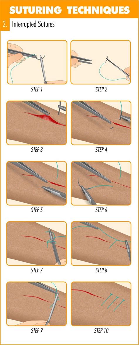 How to Suture