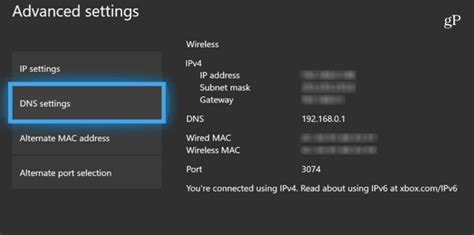 How to verify your DNS settings on an Xbox One: