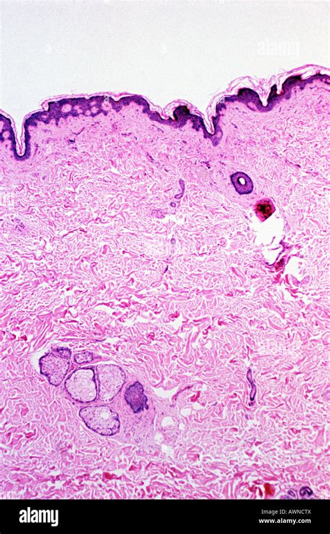 The Revealing Truth of Human Skin: An Intimate Look Under the Microscope