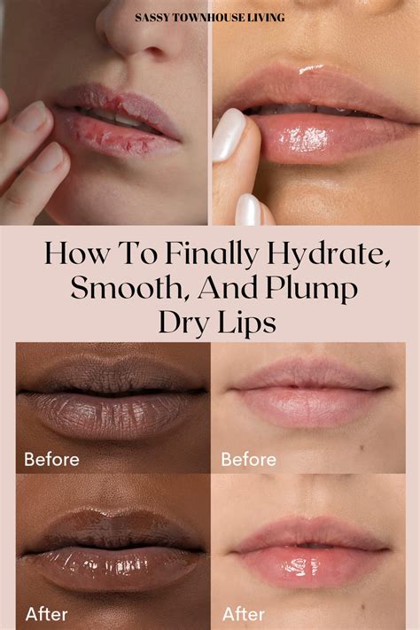 Hydrated Lips