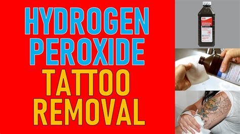 Home Tattoo Removal with Hydrogen Peroxide and Baking Soda