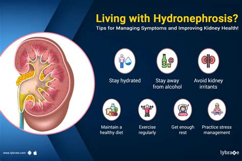 Hydronephrosis Treatment: Target the Root Cause.
