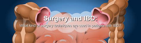 IBD Surgery: Risks, Recovery & Better Health.