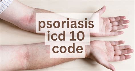 ICD 10 Codes for Different Types of Psoriasis