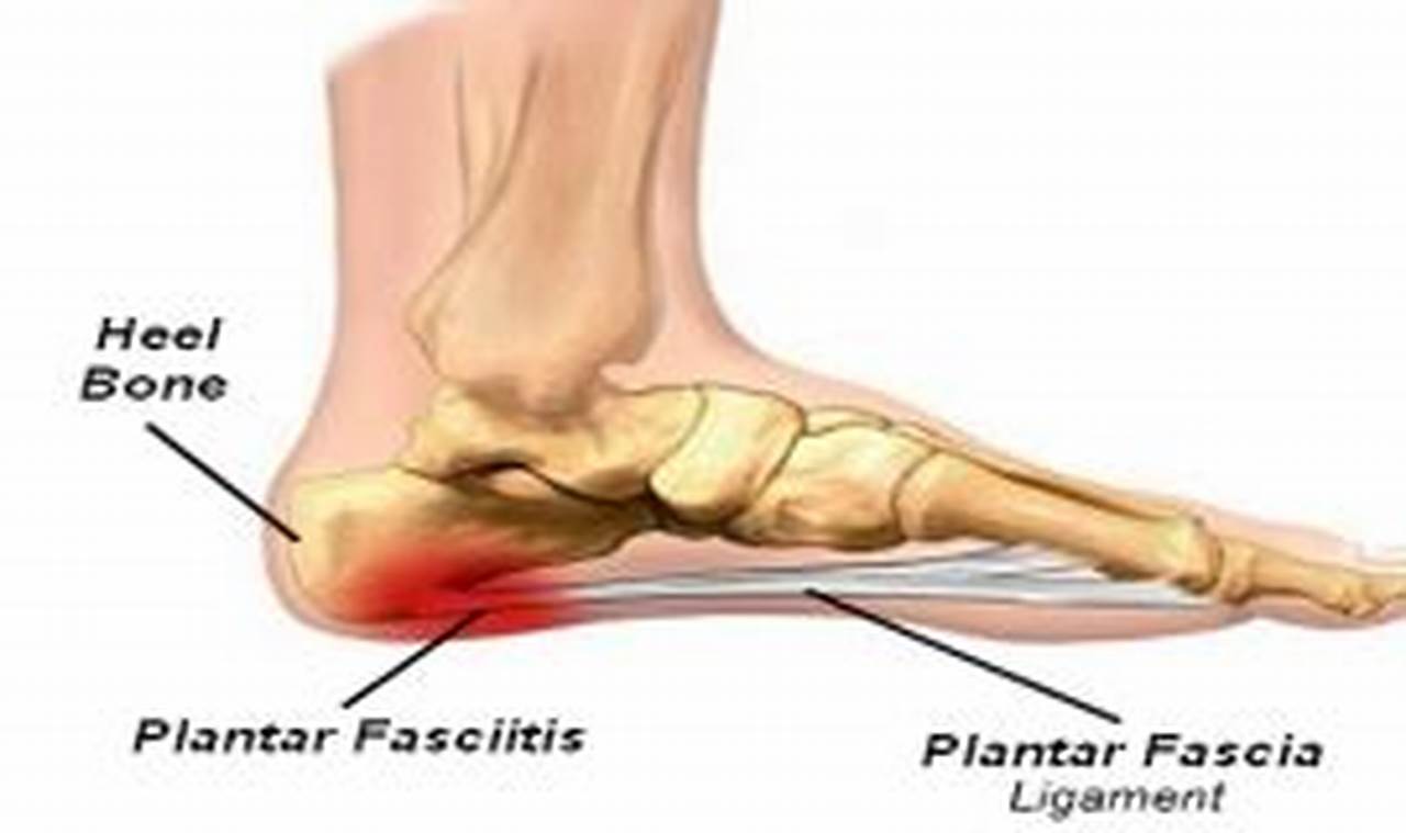 Icd 10 Code For Plantar Fasciitis