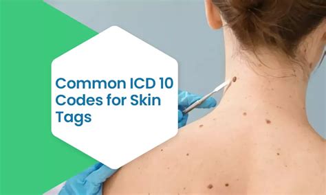 Say Goodbye to Embarrassing Skin Tags with the Revolutionary IC10 Treatment!