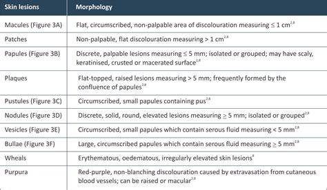 Unearthed: ICD 10 Classification of Skin Lesion Unspecified - Your Guide to Understanding and Documenting Accurately