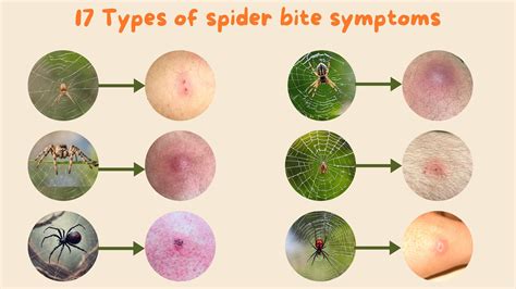 Identifying Key Dog Bit By Spider Symptoms
