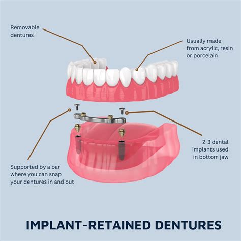 Image Of Dentures