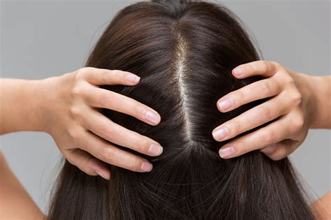 Image of Healthy Scalp With Hair Growth