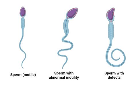 Image Of Sperm