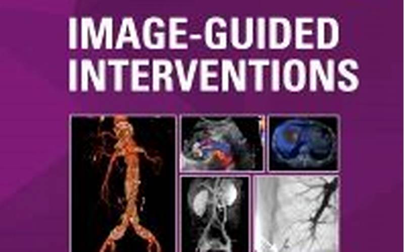 Image-Guided Interventions: Navigating The Body With Precision