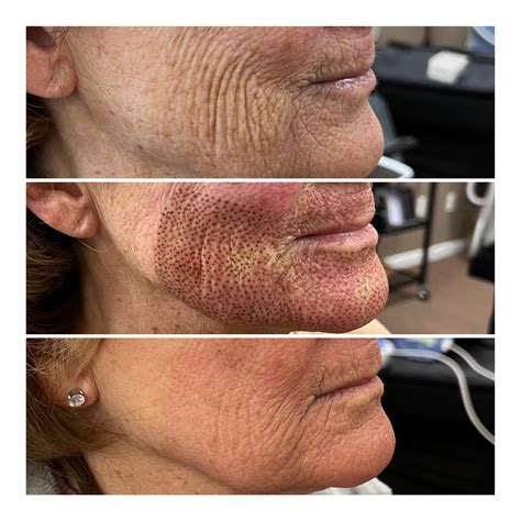 Revealing the Beauty Within: Inspiring Images of Radiant Skin You Don't Want to Miss!