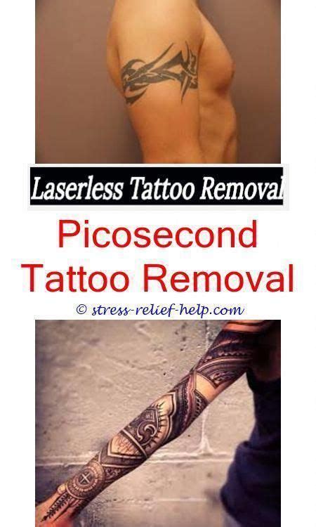 Laser Tattoo Removal experts with 15 years experience