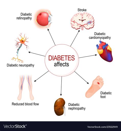 Immediate and Acute Health Issues With Diabetes