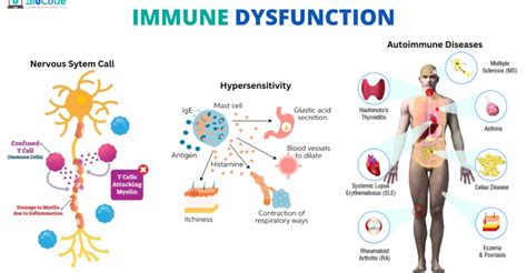 Immune System Dysfunction Theory