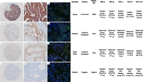 Immunohistochemistry Test and interpretation