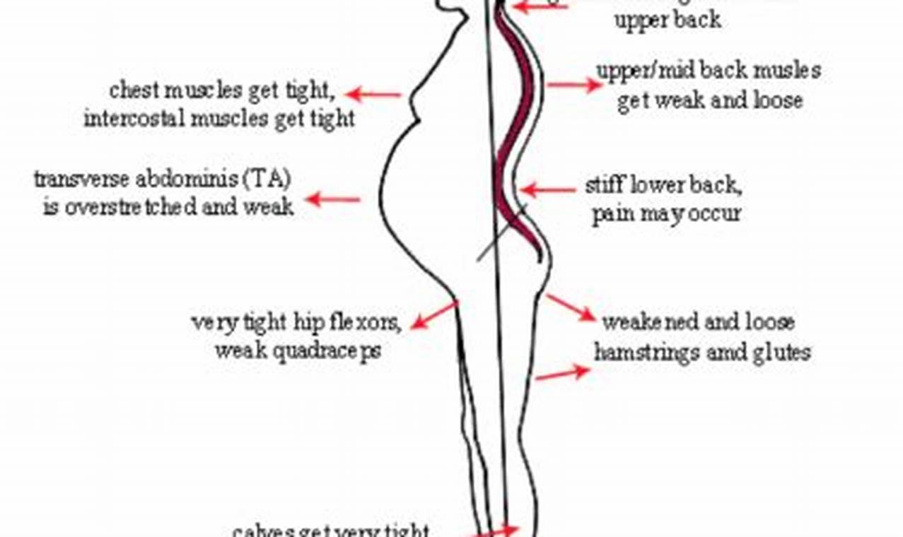 Impact of pregnancy on posture: Body alignment
