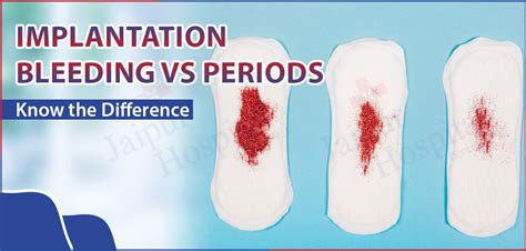 Implantation Bleeding Look Like Period