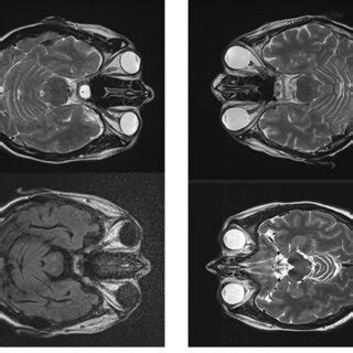 Impressive differences