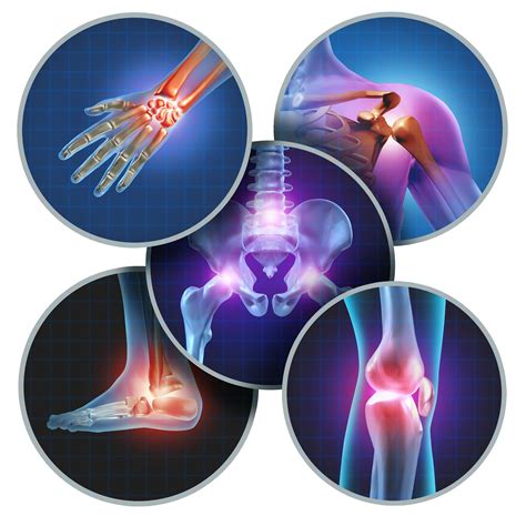 Improving Joint Health