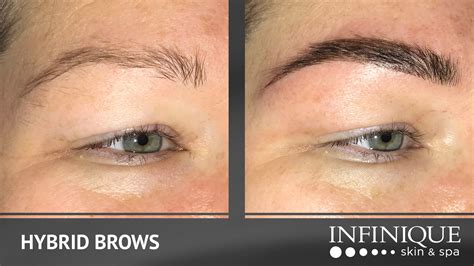 Transform Your Skin with the Luxurious Treatments of Infinique Skin & Spa LLC - Indulge in Ultimate Pampering!