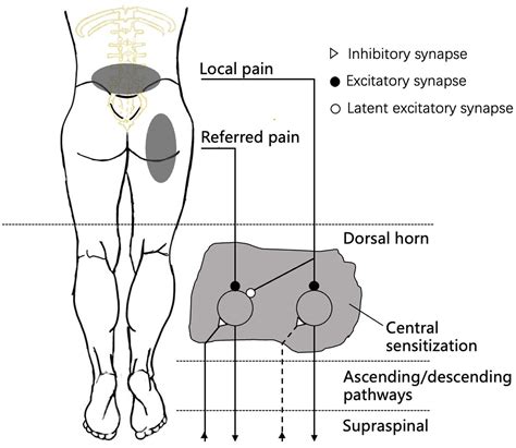 Inflammation and Pain Referral