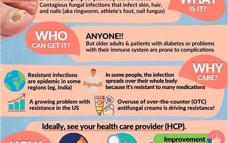 Infographic Of Fungal Infection Remedy