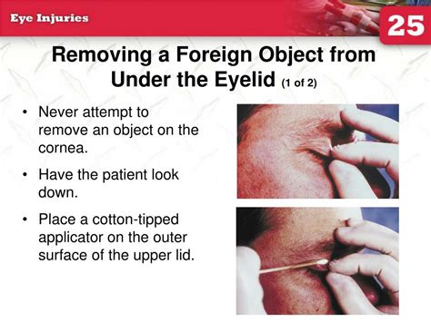 Injuries and Foreign Objects