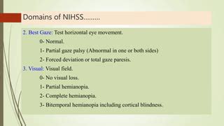 Innovation in Forced Deviation NIHSS