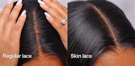 Innovation in Lace Technology