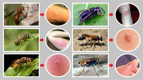 Insect Stings: Identification & Effective Treatment