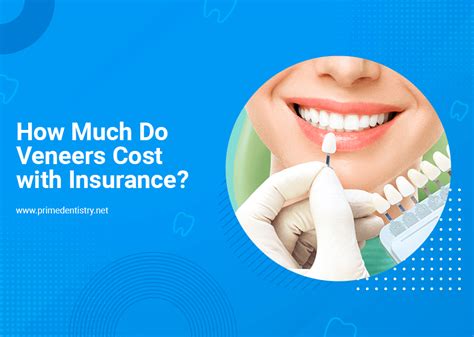 Insurance For Veneers