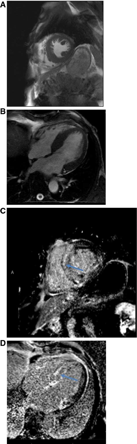 Integrating Imaging Findings