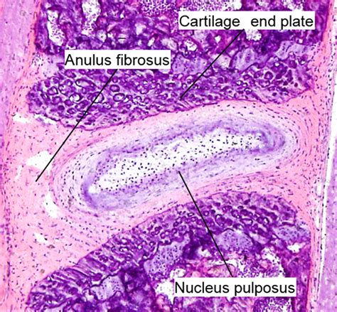 Disc Histology